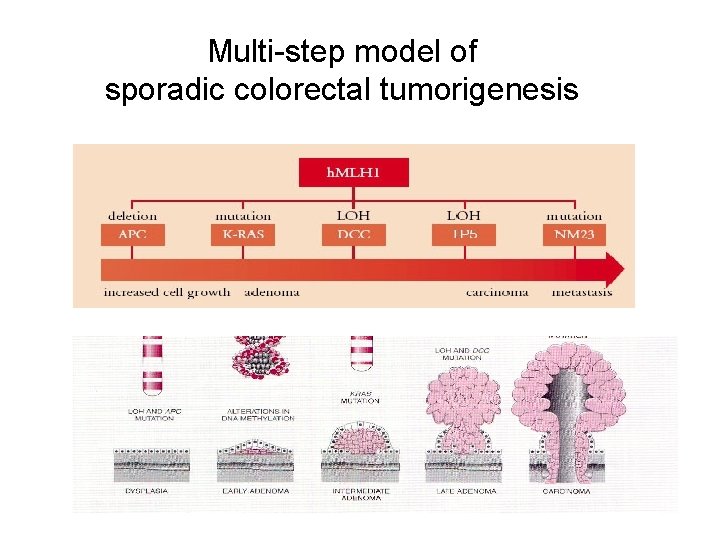 Multi-step model of sporadic colorectal tumorigenesis 