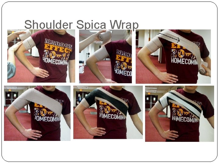 Shoulder Spica Wrap 
