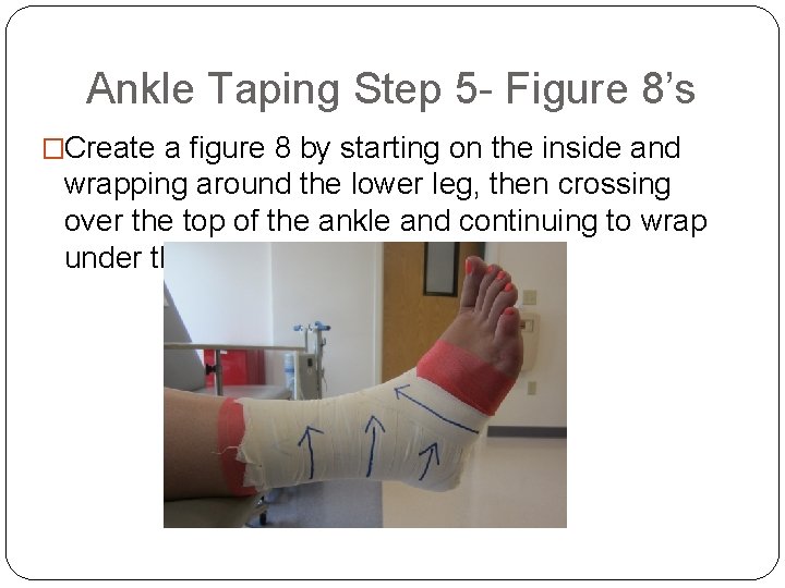 Ankle Taping Step 5 - Figure 8’s �Create a figure 8 by starting on
