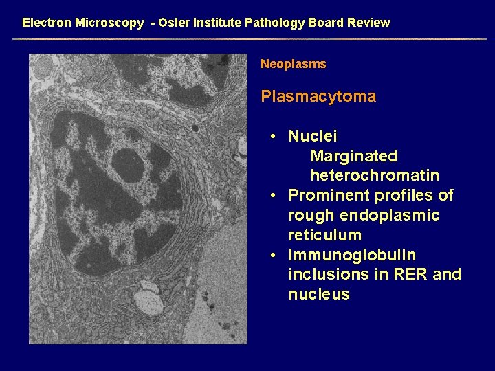 Electron Microscopy - Osler Institute Pathology Board Review Neoplasms Plasmacytoma • Nuclei Marginated heterochromatin