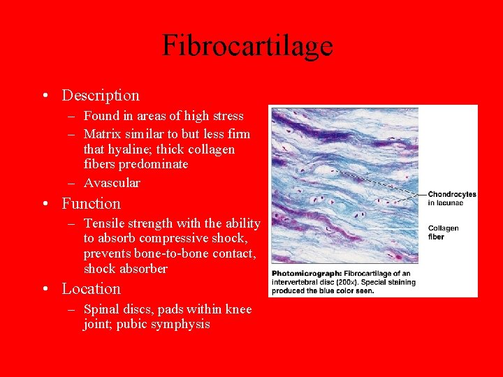 Fibrocartilage • Description – Found in areas of high stress – Matrix similar to