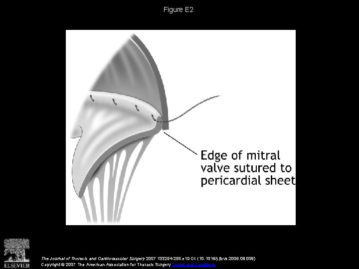 Figure E 2 The Journal of Thoracic and Cardiovascular Surgery 2007 133254 -255. e