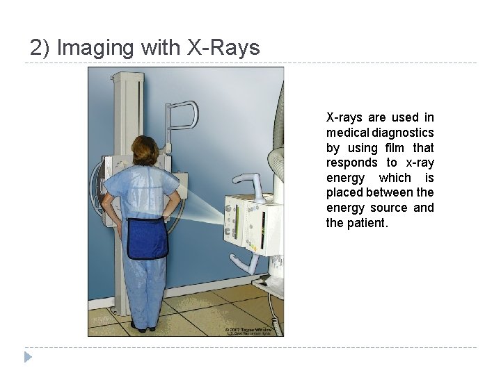 2) Imaging with X-Rays X-rays are used in medical diagnostics by using film that