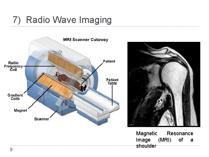7) Radio Wave Imaging Magnetic Resonance Image (MRI) of a shoulder 