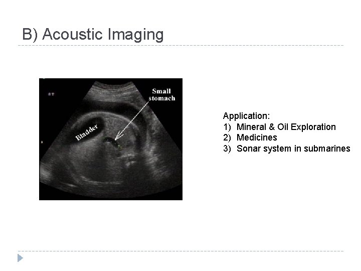 B) Acoustic Imaging Application: 1) Mineral & Oil Exploration 2) Medicines 3) Sonar system