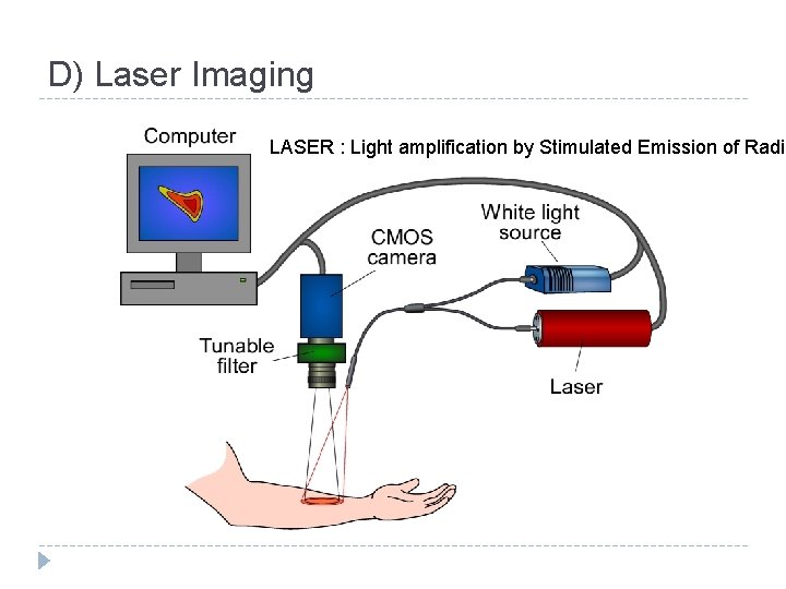 D) Laser Imaging LASER : Light amplification by Stimulated Emission of Radia 