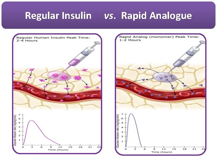 Regular Insulin vs. Rapid Analogue 