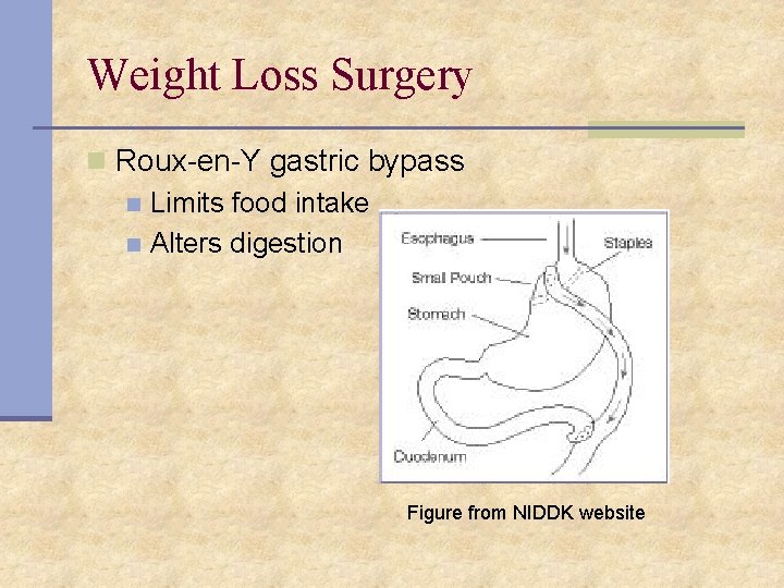 Weight Loss Surgery n Roux-en-Y gastric bypass n Limits food intake n Alters digestion