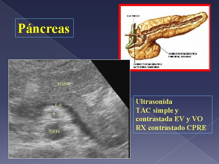 Páncreas Ultrasonida TAC simple y contrastada EV y VO RX contrastado CPRE 