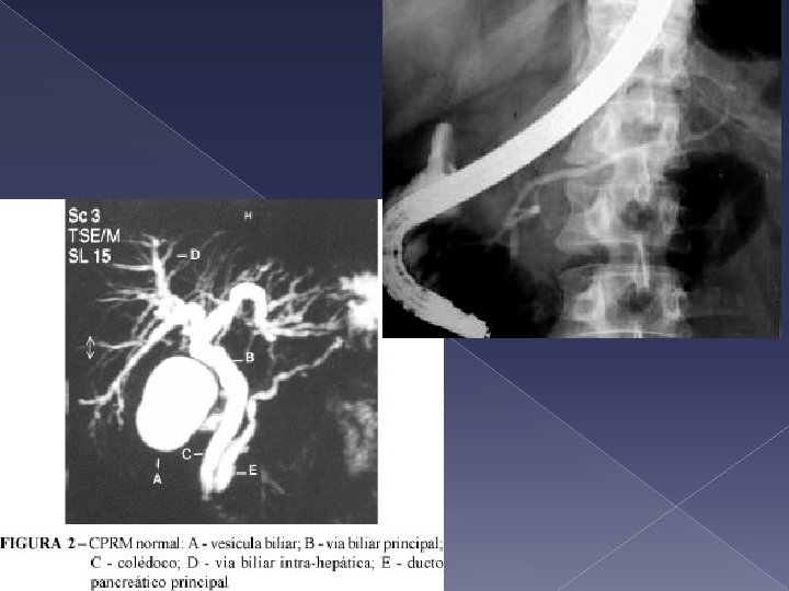 CABEZA 2, 5 CM CUERPO 