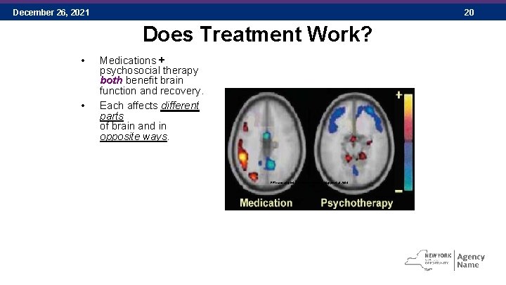 December 26, 2021 20 Does Treatment Work? • • Medications + psychosocial therapy both