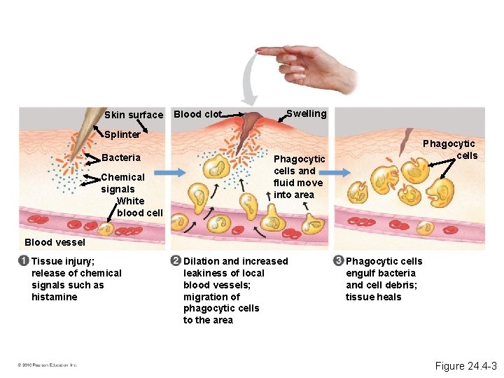 Skin surface Blood clot Swelling Splinter Bacteria Chemical signals White blood cell Phagocytic cells