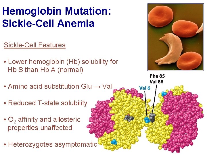 Hemoglobin Mutation: Sickle-Cell Anemia Sickle-Cell Features • Lower hemoglobin (Hb) solubility for Hb S
