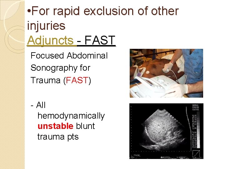  • For rapid exclusion of other injuries Adjuncts - FAST Focused Abdominal Sonography