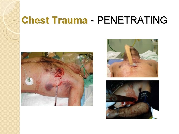 Chest Trauma - PENETRATING 