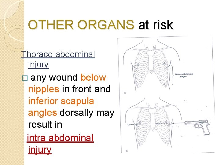 OTHER ORGANS at risk Thoraco-abdominal injury any wound below nipples in front and inferior