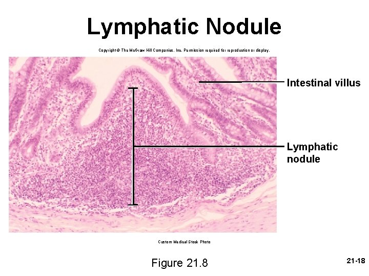 Lymphatic Nodule Copyright © The Mc. Graw-Hill Companies, Inc. Permission required for reproduction or