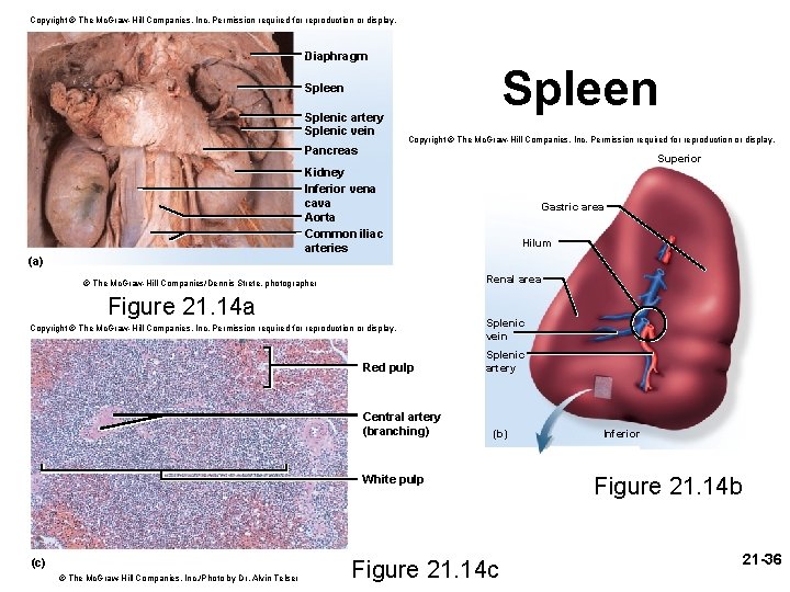 Copyright © The Mc. Graw-Hill Companies, Inc. Permission required for reproduction or display. Diaphragm