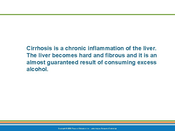 Cirrhosis is a chronic inflammation of the liver. The liver becomes hard and fibrous