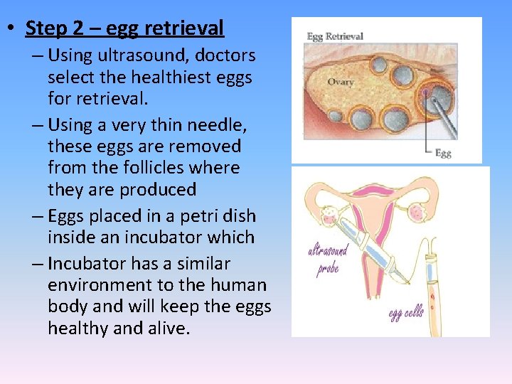  • Step 2 – egg retrieval – Using ultrasound, doctors select the healthiest