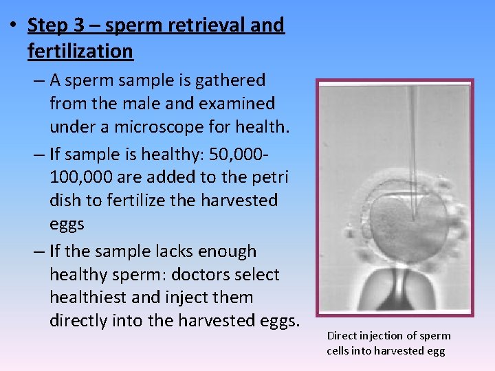  • Step 3 – sperm retrieval and fertilization – A sperm sample is