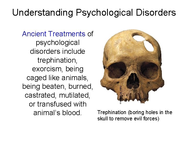Understanding Psychological Disorders John W. Verano Ancient Treatments of psychological disorders include trephination, exorcism,