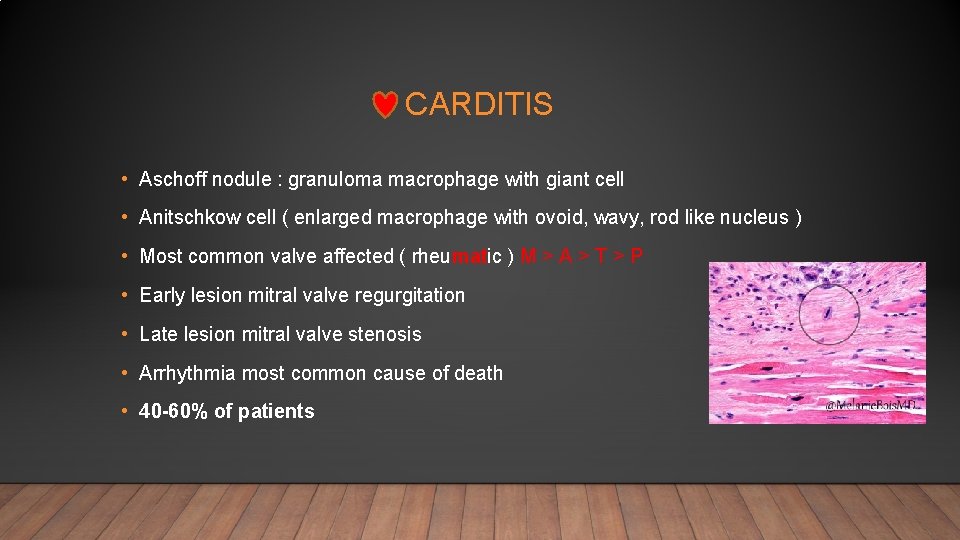 CARDITIS • Aschoff nodule : granuloma macrophage with giant cell • Anitschkow cell (