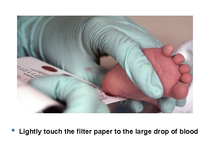  • Lightly touch the filter paper to the large drop of blood 