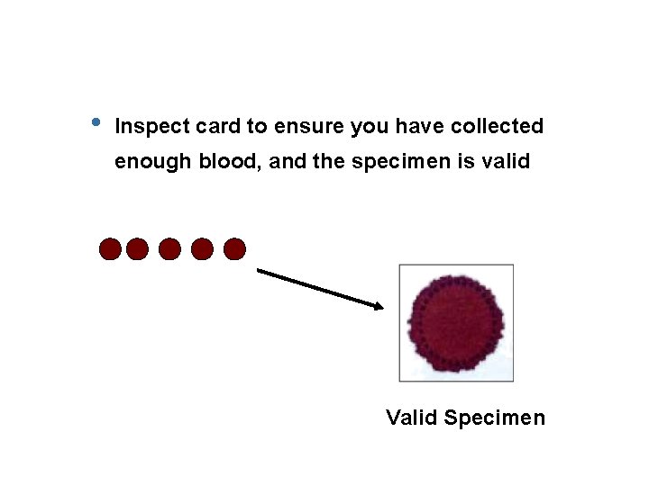  • Inspect card to ensure you have collected enough blood, and the specimen