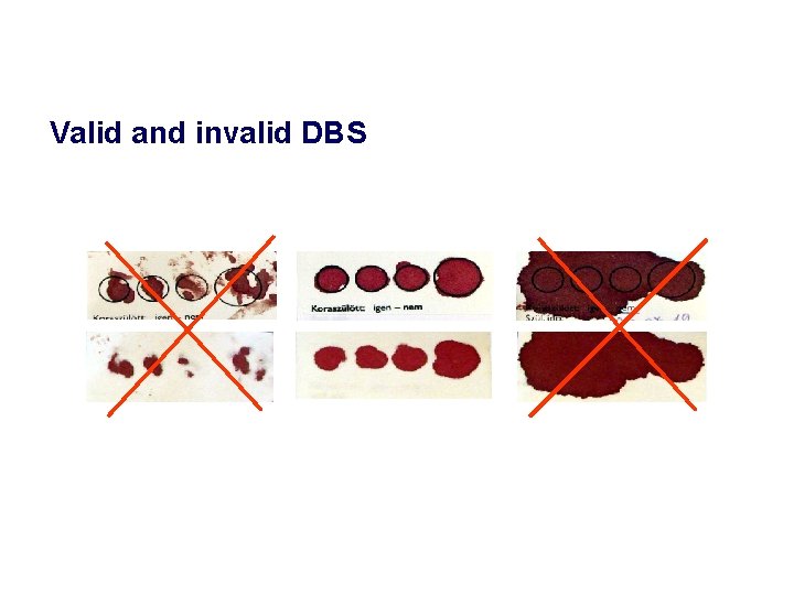 Valid and invalid DBS 