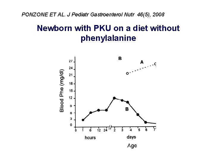 PONZONE ET AL. J Pediatr Gastroenterol Nutr 46(5), 2008 Newborn with PKU on a