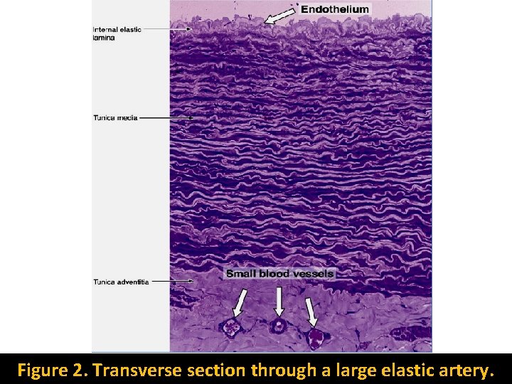 Figure 2. Transverse section through a large elastic artery. 
