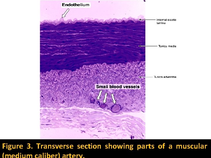 Figure 3. Transverse section showing parts of a muscular 