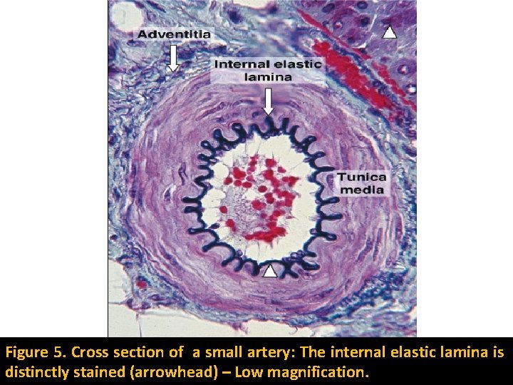 Figure 5. Cross section of a small artery: The internal elastic lamina is distinctly