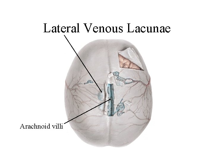 Lateral Venous Lacunae Arachnoid villi 