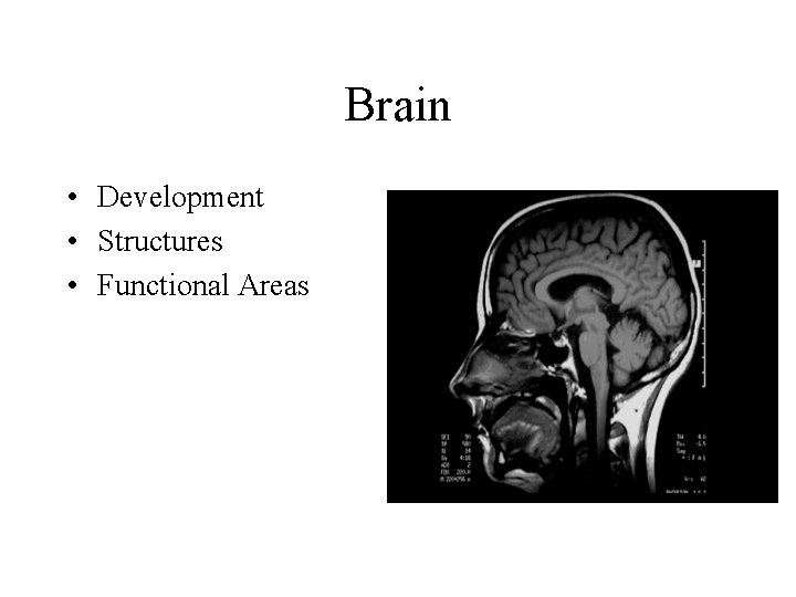 Brain • Development • Structures • Functional Areas 