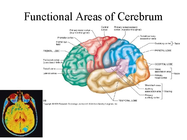 Functional Areas of Cerebrum 