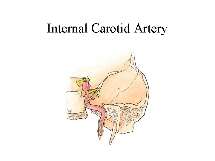 Internal Carotid Artery 