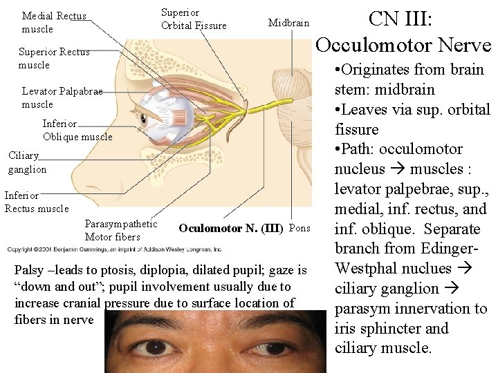 Medial Rectus muscle Superior Orbital Fissure Midbrain Superior Rectus muscle Levator Palpabrae muscle Inferior