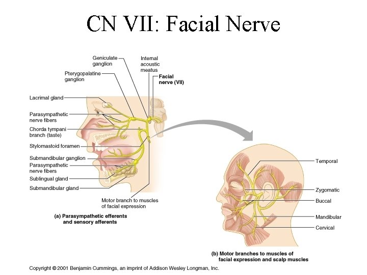 CN VII: Facial Nerve 