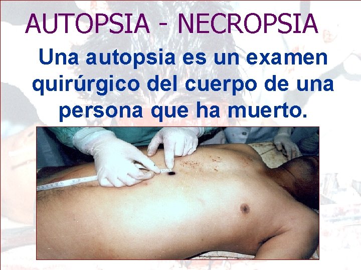 AUTOPSIA - NECROPSIA Una autopsia es un examen quirúrgico del cuerpo de una persona