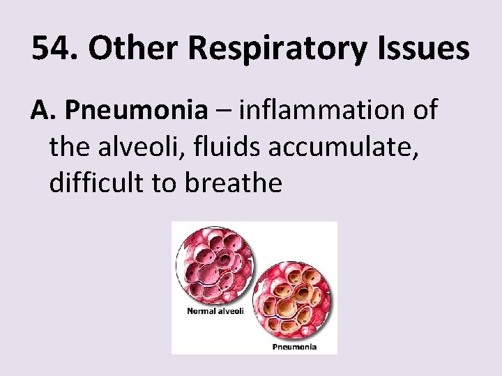 54. Other Respiratory Issues A. Pneumonia – inflammation of the alveoli, fluids accumulate, difficult