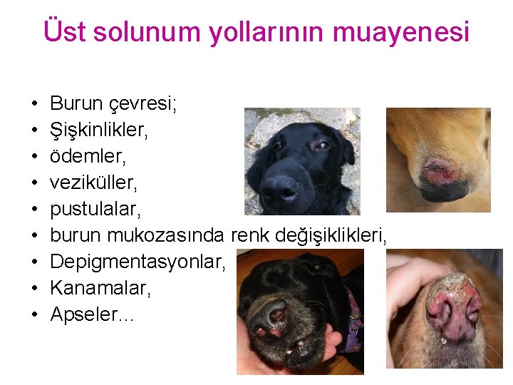 Üst solunum yollarının muayenesi • • • Burun çevresi; Şişkinlikler, ödemler, veziküller, pustulalar, burun