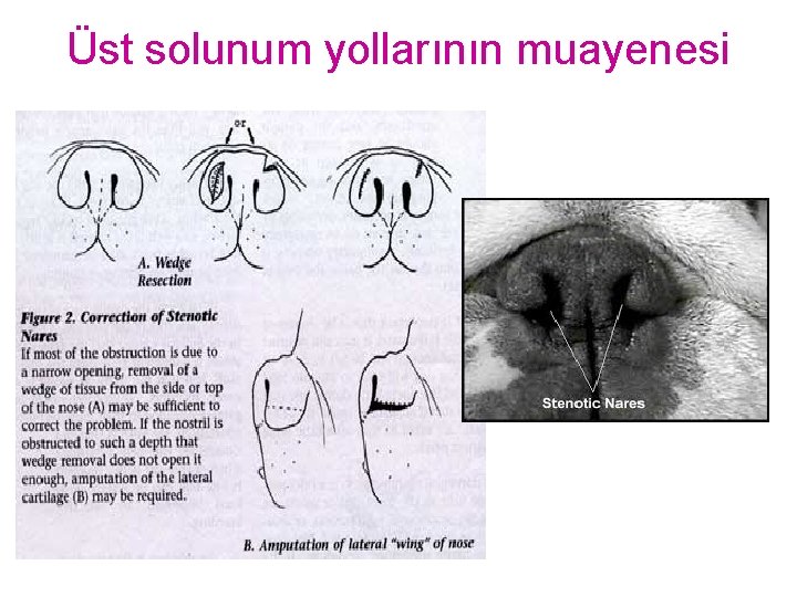 Üst solunum yollarının muayenesi 