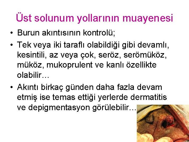 Üst solunum yollarının muayenesi • Burun akıntısının kontrolü; • Tek veya iki taraflı olabildiği