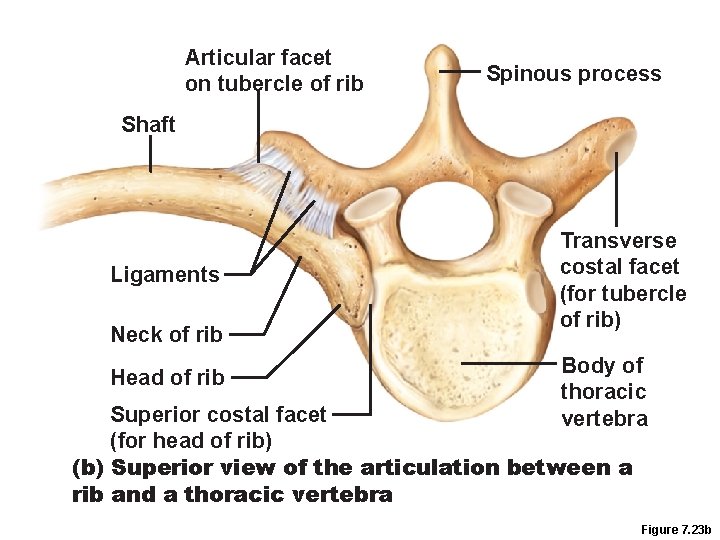 Articular facet on tubercle of rib Spinous process Shaft Ligaments Neck of rib Head