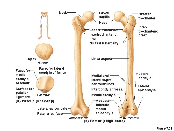 Neck Fovea capitis Greater trochanter Head Intertrochanteric crest Lesser trochanter Intertrochanteric line Gluteal tuberosity