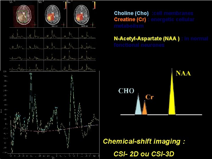 Choline (Cho) : cell membranes Creatine (Cr) : energetic cellular metabolism N-Acetyl-Aspartate (NAA )