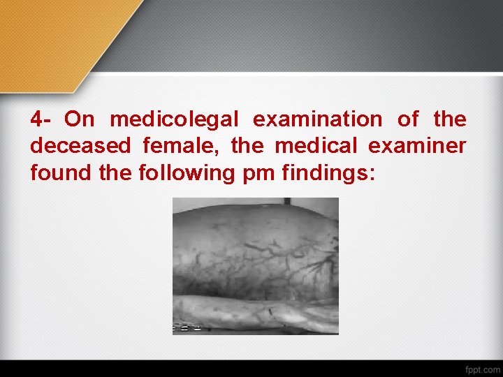 4 - On medicolegal examination of the deceased female, the medical examiner found the