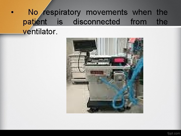  • No respiratory movements when the patient is disconnected from the ventilator. 